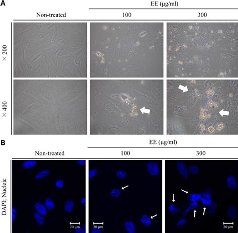 Figure 2 From Extract From Eucheuma Cottonii Induces Apoptotic Cell