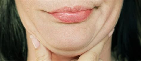 what causes a double chin causes and treatment options atlanta face and body