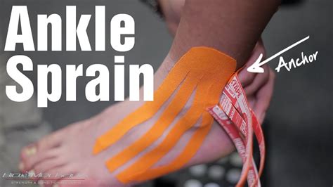 How to wrap a sprained foot with athletic tape. How to Kinesio Tape for an Ankle Sprain with RockTape Rock ...