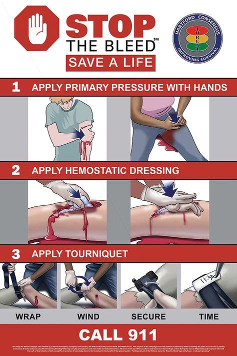60 Best First Aid For Bleeding Images On Pinterest In 2018 First Aid