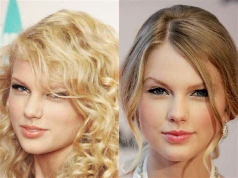 Taylor Swift Plastic Surgery Taylor Swift Nose Job Taylor Swift