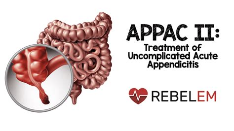 Appendicitis Archives Rebel Em Emergency Medicine Blog