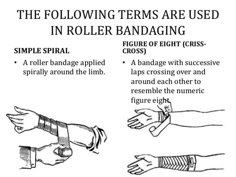 Cast — synonyms and related words: Bandaging and Splinting & Slings; Techniques and Types ...