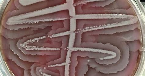 Proteus Swarming On An Agar Plate Microbiology Pinterest