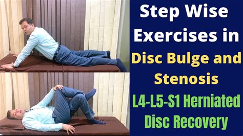 Exercises For Herniated Disc Disc Bulge L4 L5 S1 Step Wise Treatment