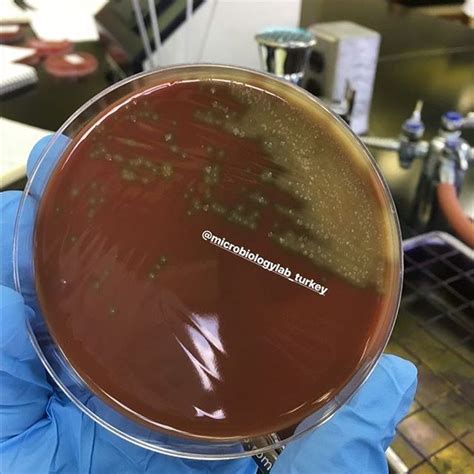 Microbiology Turkey 🔬 On Instagram Streptococcus Viridans On