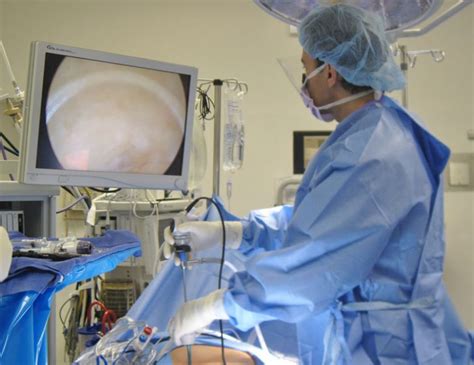 Laparoscopic Hernia Repair Hernia Surgery