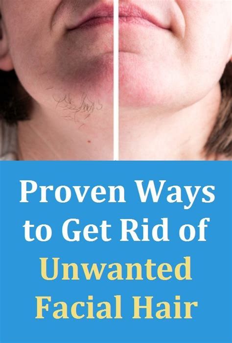 You may look unkempt at the office for awhile its just part of the process consider taking some vitamins How to Get Rid of Unwanted Facial Hair Naturally in 2020 ...