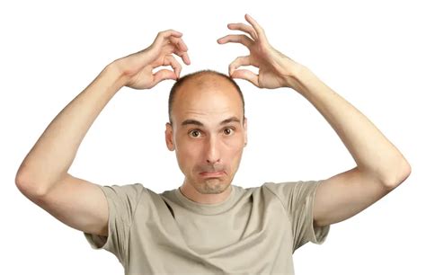 Acupuncture For Male Pattern Baldness Everything You Need To Know