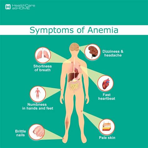 Know The Symptoms Of Anemia And Take Appropriate Action Before Its Too