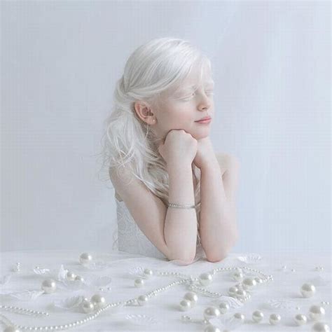 These Stunning Photos Depict Albinism In A Beautiful Light Com Imagens