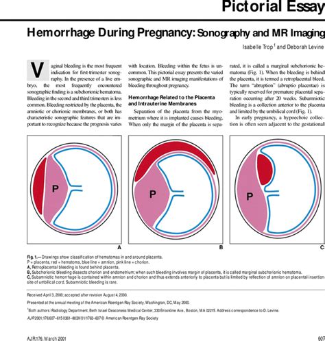 Hemorrhage During Pregnancy Sonography And Mr Imaging Ajr