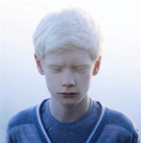 Image About Boy In Albino By Hey Henry On We Heart It Albino Human