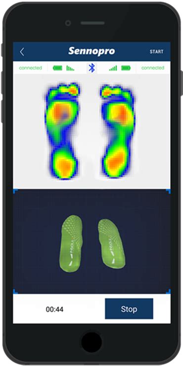 High Resolution Plantar Pressure Map And Foot Posture Data Smart