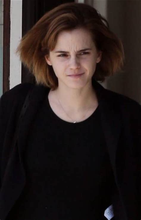 Emma Watson Without Makeup 10 Pics Picture 10