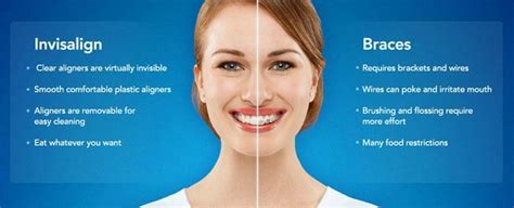 Top 7 Things You Should Know About Invisalign
