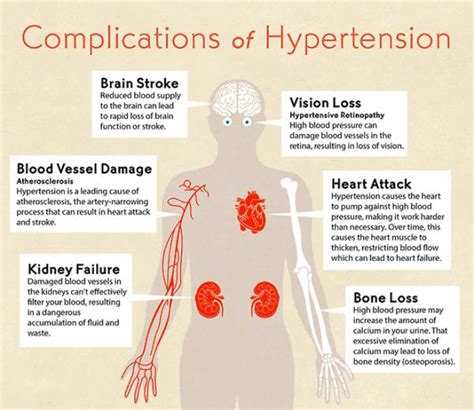Alabama Clinics Do You Have Hypertension