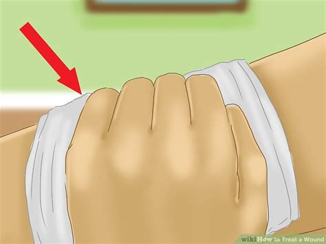 How To Treat A Wound 10 Steps With Pictures Wikihow