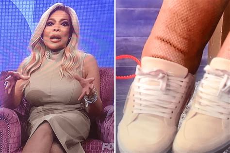 PHOTOS Wendy Williams Steps Out In DISTURBING Outfit Covered With