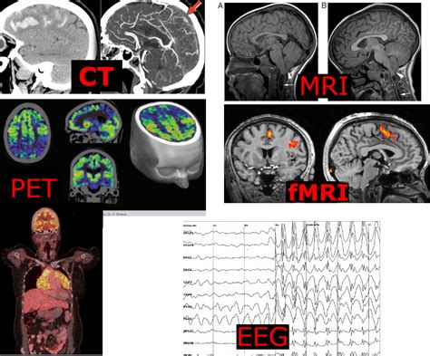 Here Is An Overview Of The Technologies Used To Study The Brain Ct