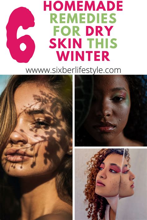 The Best 6 Homemade Remedies For Very Dry Skin This Winter In 2021