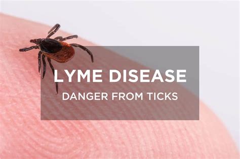 Lyme Disease Danger From Ticks Bangkok Hospital Phuket