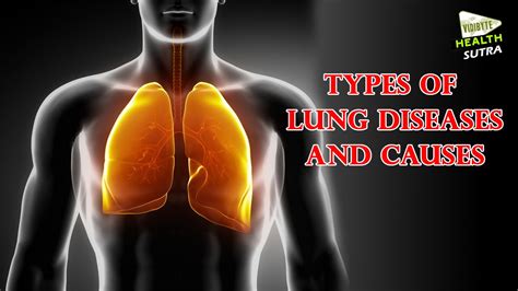 Types Of Lung Diseases And Causes Health Sutra Youtube