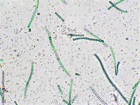 Nostoc Sp Algae Under Microscopic View Cyanobacteria Blue Green