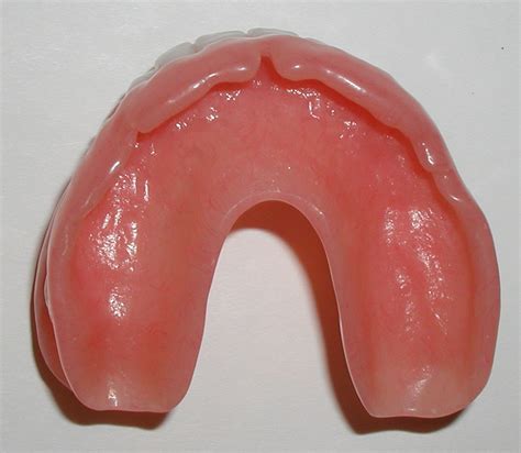 List 98 Pictures Images Of Upper Dentures Completed