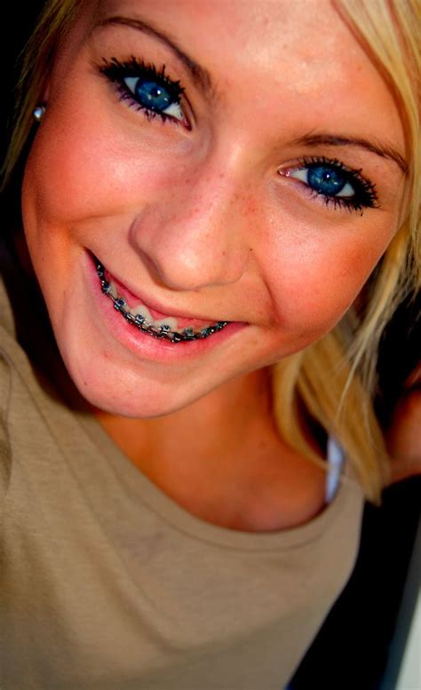 Blue Eyed Blonde With Braces Beautiful Smile Cute Braces Brace Face Septum Ring Nose Ring