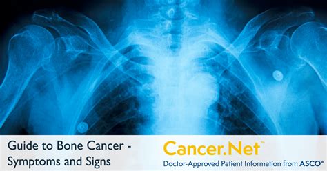 Bone Cancer Sarcoma Of Bone Symptoms And Signs Cancer Net