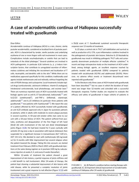 A Case Of Acrodermatitis Continua Of Hallopeau Successfully Treated