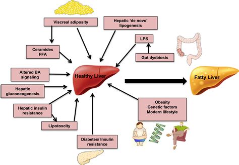 Perturbation Of The Circadian Clock And Pathogenesis Of Nafld