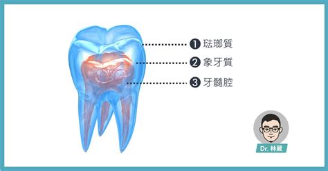 Dr 林葳牙科診療室 牙齒會敏感，快找牙醫看！