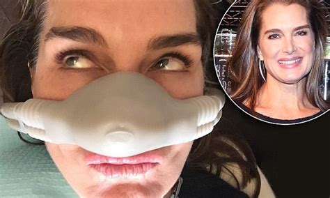 Brooke Shields Undergoes Dental Surgery For Teeth Grinding Daily Mail