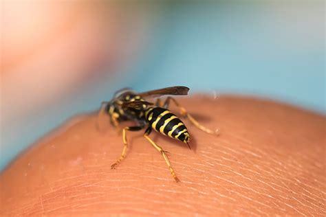 yellow jacket stings first aid home remedies and self care tips the best home