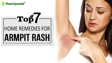 Top 7 Home Remedies For Armpit Rash