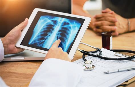 Artificial Intelligence Identifies Lung Cancer Patients At Risk Of Harm