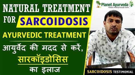 Natural Treatment For Sarcoidosis Herbal Remedies Real Testimonial
