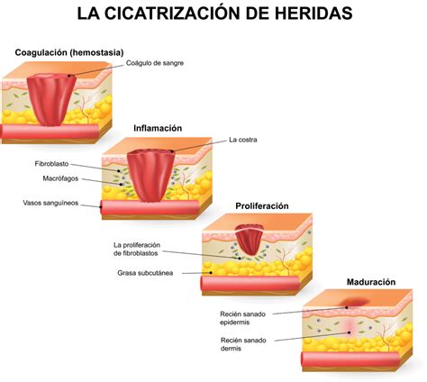 Las 4 Fases Principales De La Cicatrización De Heridas Shield Healthcare