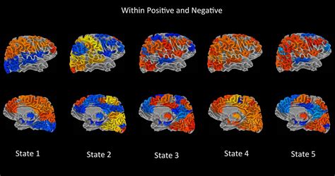 Frontiers Dynamic Connectivity States Estimated From Resting Fmri