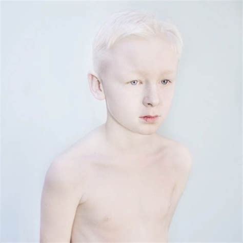Snow White Striking Portraits Of People With Albinism Art Sheep