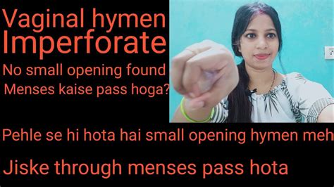 Vaginal Hymenimperforate Hymen Youtube