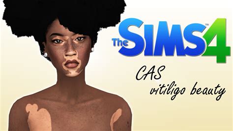 The Sims 4 Vitiligo Skin Details Sims 4 Cc Kellydli