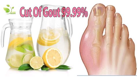 Gout Treatment How To Cure Gout Fast At Home With Lemon Juice It Is