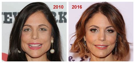 Jaw Botox The Secret To Real Housewife Bethenny Frankels New Look Zwivel