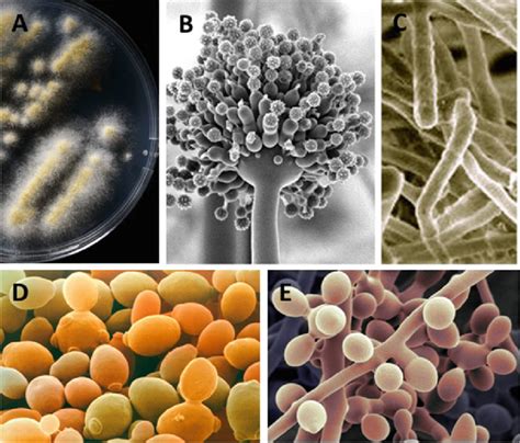 1 Fungal Hall Of Fame Illustrating The Five Types Of Fungi Which Are