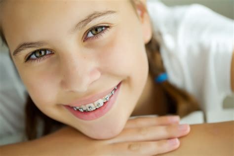 Invisalign Vs Braces Which One Is Suited For You