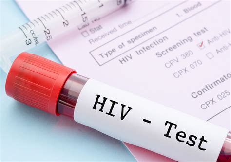 Australian Law Needs A Refresher On The Science Of Hiv Transmission