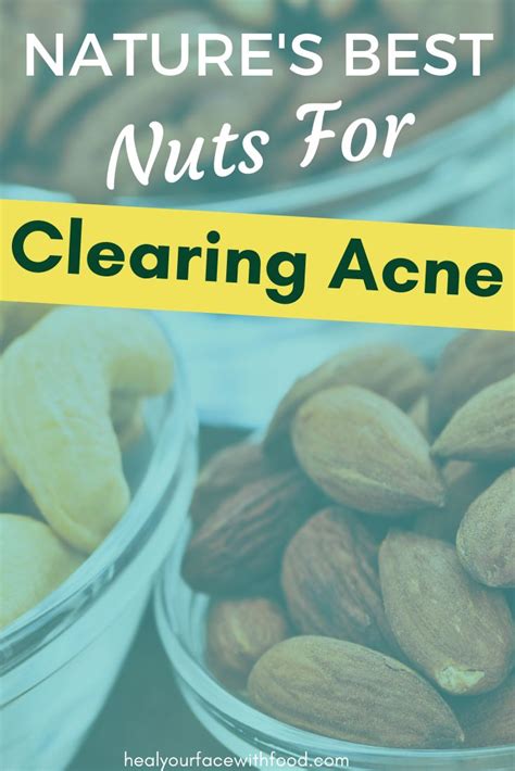 Best Nuts For Clear Skin Heal Your Face With Food Foods For Clear